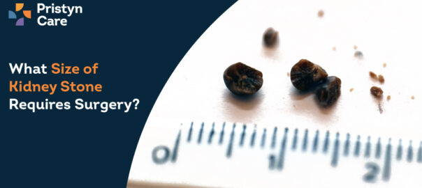 What Size of Kidney Stone Requires Surgery?