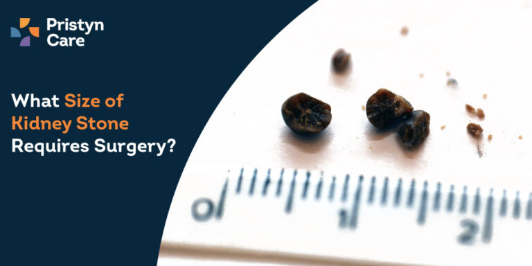 What Size of Kidney Stone Requires Surgery