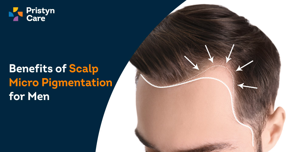 Benefits-of-Scalp-Micro-Pigmentation-for-Men