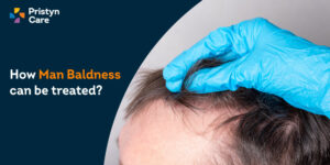 Man Baldness Treatment