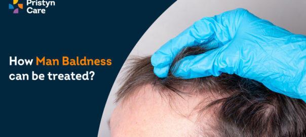 What is Male Pattern Hair Loss or Baldness? How Can It Be Treated?