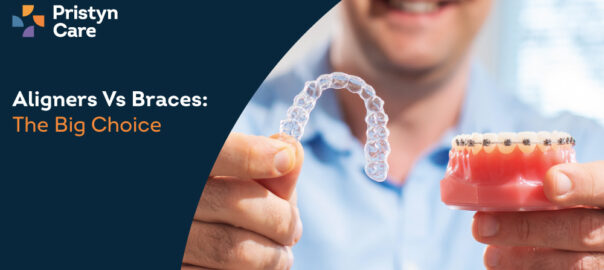 Aligners and Braces – Which is Best for You?