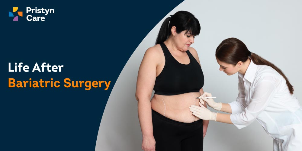 Tummy Tuck Surgery in Kurukshetra, Abdominoplasty in Kurukshetra