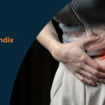 Cost of Appendix (laparoscopic) Surgery in Bhubaneswar