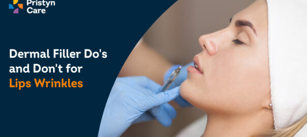 Dermal Filler: Do’s and Don’ts for Lips Wrinkles