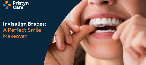 Get A Perfect Smile Using Invisible Aligners