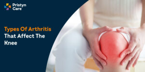 Types-Of-Arthritis-That-Affect-The-Knee