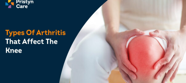 7 Types of Arthritis that Affect the Knee