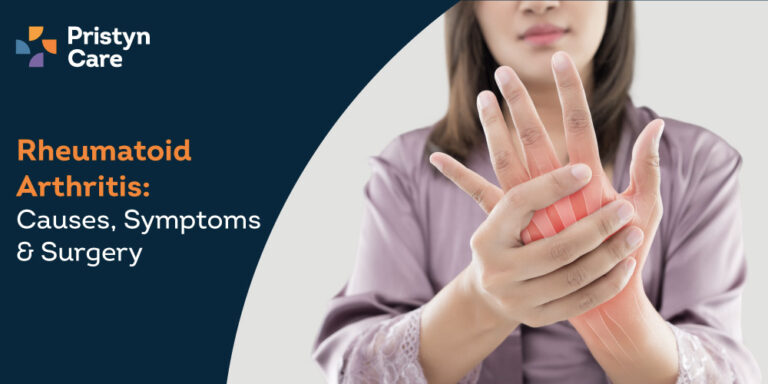 Rheumatoid Arthritis – Causes, Symptoms & Surgery