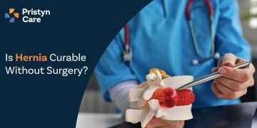 Is Hernia Curable Without Surgery