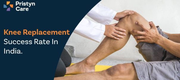 Knee Replacement Success Rate In India