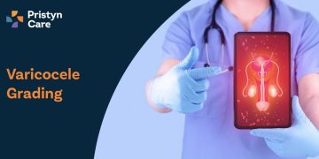 Varicocele Grading