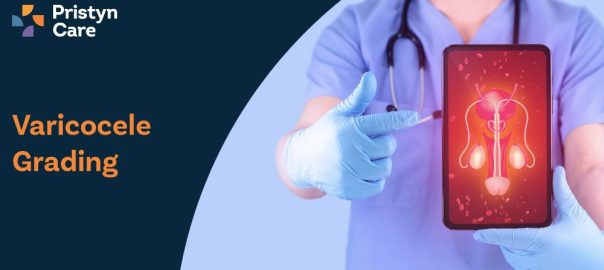 Varicocele Grading