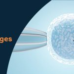 what are the 5 stages of IVF