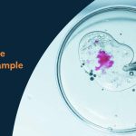 How-To-Get-The-Best-Sperm-Sample-For-IVF