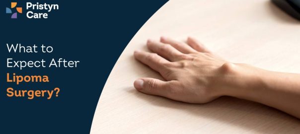 What to Expect After Lipoma Surgery?