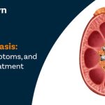 Nephrolithiasis Causes, Symptoms, and Effective Treatment Options