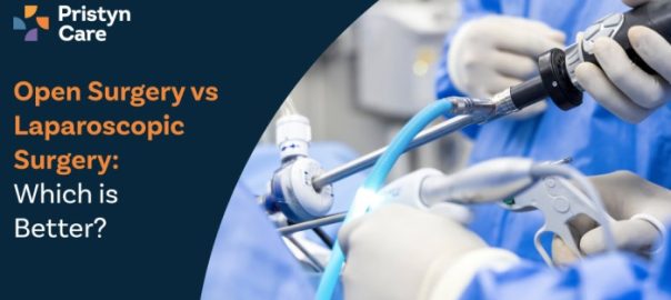 Open Surgery vs Laparoscopic Surgery: Which is Better?