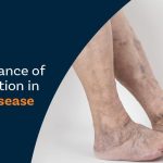 The Importance Of Early Detection In Vascular Disease