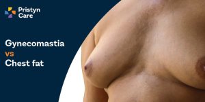 Gynaecomastia vs Chest Fat​