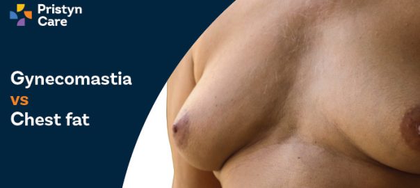Gynaecomastia vs Chest Fat​