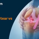 meniscus tear vs acl tear