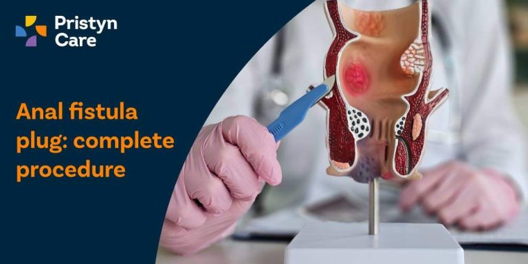 Anal Fistula Plug