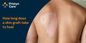 How long does a skin graft take to heal​