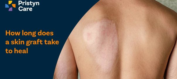 How Long Does A Skin Graft Take To Heal​?