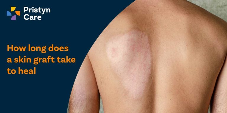 How long does a skin graft take to heal​