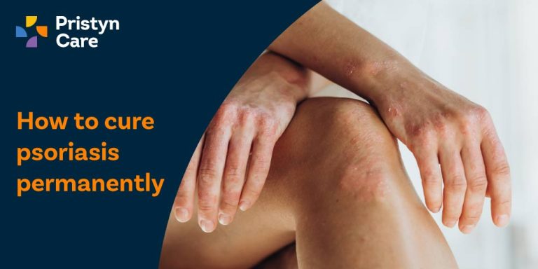 How to cure psoriasis permanently