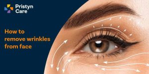 How to remove wrinkles from face​
