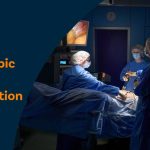 Laparoscopic Nissen Fundoplication