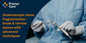 Ureteroscopic Stone Fragmentation