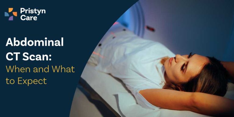 Abdominal CT Scan
