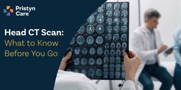 Head CT Scan