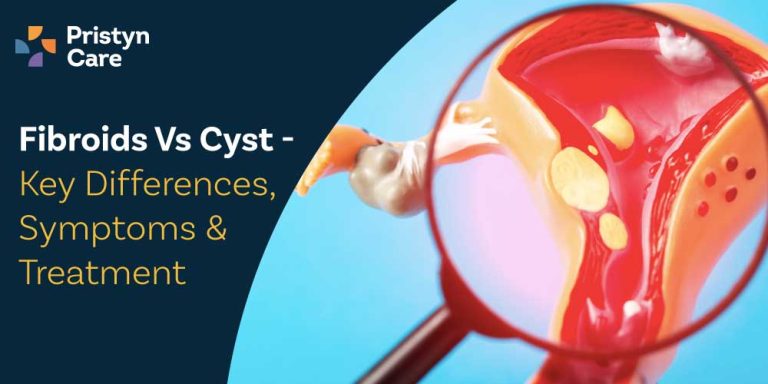 fibroid vs cysts