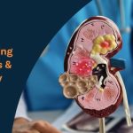 Understanding-VUJ-Calculus-&-Calyx-Kidney-Stones