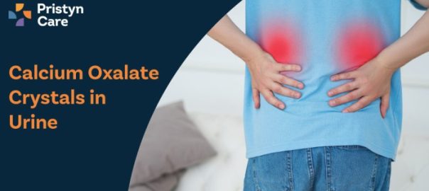 Calcium Oxalate Crystals in Urine – Causes, Symptoms & Treatment
