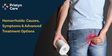 Hemorrhoids Treatment