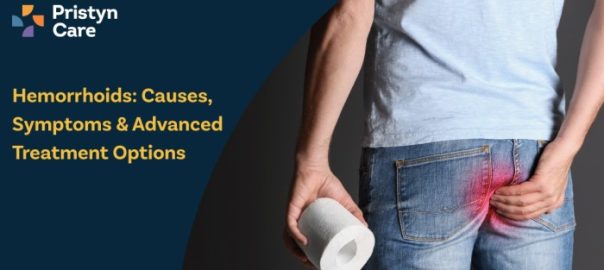 Hemorrhoids: Types, Causes, Symptoms & Advanced Treatment