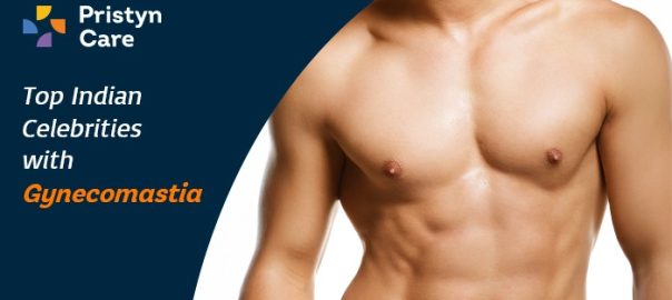 Top Indian Celebrities with Gynecomastia