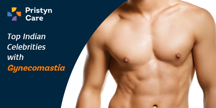 Top Indian Celebrities with Gynecomastia