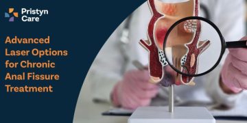 Advanced-Laser-Options-for-Chronic-Anal-Fissure-Treatment