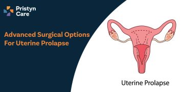 Advanced Surgical Options for Uterine Prolapse