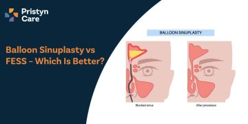 Balloon Sinuplasty vs FESS – Which Is Better?
