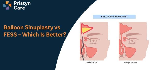 Balloon Sinuplasty vs FESS – Which Is Better?