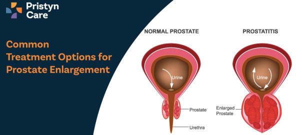Common Treatment Options for Prostate Enlargement