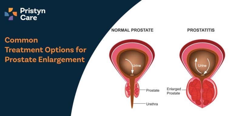 Common-Treatment-Options-for-Prostate-Enlargement