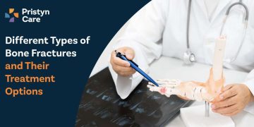 Different-Types-of-Bone-Fractures-and-Their-Treatment-Options
